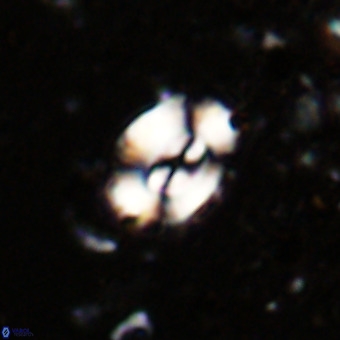Watznaueria fossacincta VR 20467