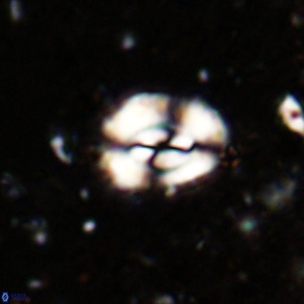 Watznaueria fossacincta VR 20468