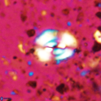 Watznaueria fossacincta VR 20469