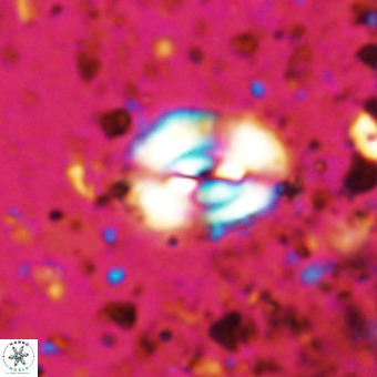 Watznaueria fossacincta VR 20469