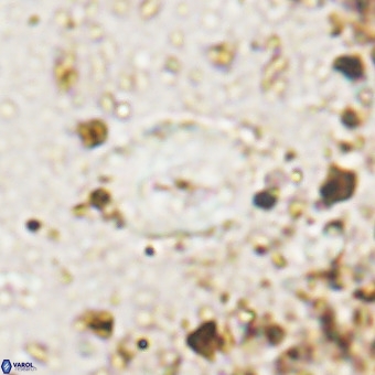 Watznaueria fossacincta VR 20470