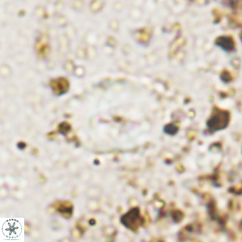 Watznaueria fossacincta VR 20470