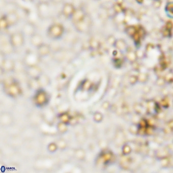 Watznaueria fossacincta VR 20471