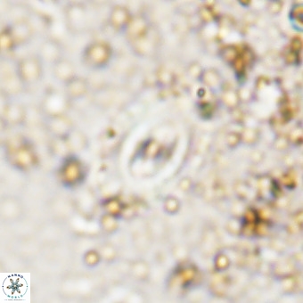 Watznaueria fossacincta VR 20471