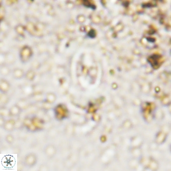 Watznaueria fossacincta VR 20472