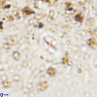 Watznaueria fossacincta VR 20473