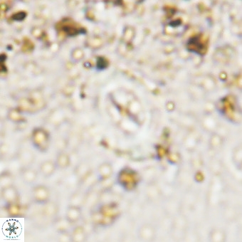 Watznaueria fossacincta VR 20473