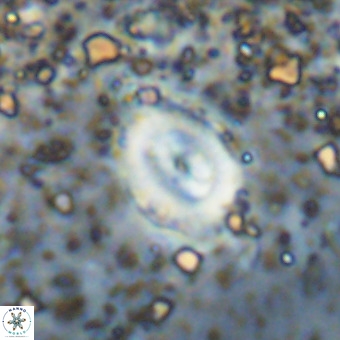 Watznaueria fossacincta VR 20475