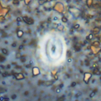 Watznaueria fossacincta VR 20476