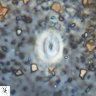 Watznaueria fossacincta VR 20476