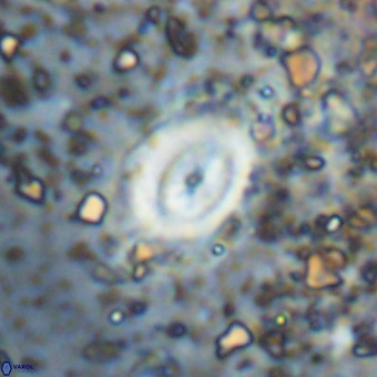 Watznaueria fossacincta VR 20477
