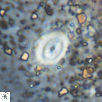 Watznaueria fossacincta VR 20477