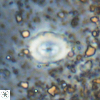 Watznaueria fossacincta VR 20478
