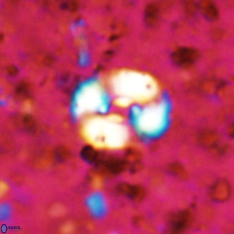 Watznaueria fossacincta VR 20842