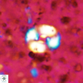 Watznaueria fossacincta VR 20842
