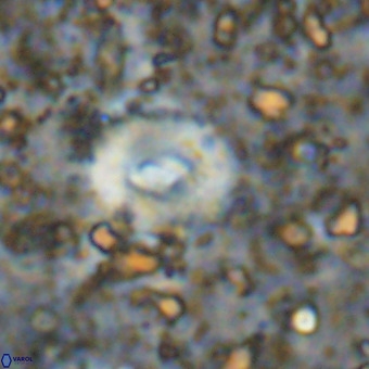 Watznaueria fossacincta VR 20821