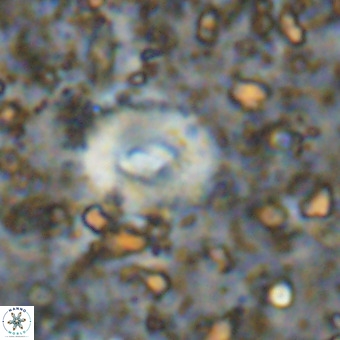 Watznaueria fossacincta VR 20821