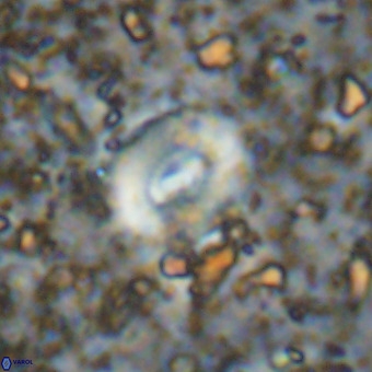 Watznaueria fossacincta VR 20822