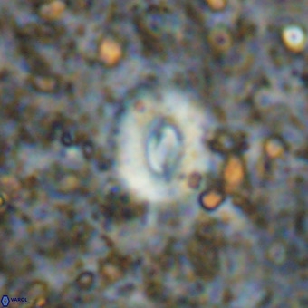 Watznaueria fossacincta VR 20823