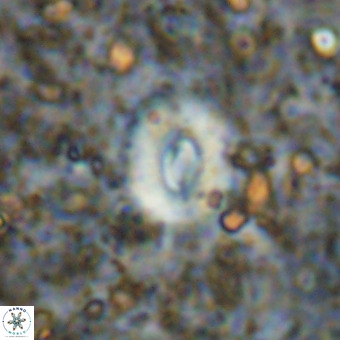 Watznaueria fossacincta VR 20823
