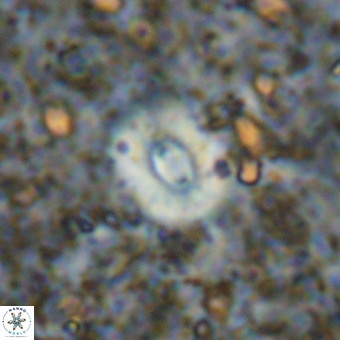 Watznaueria fossacincta VR 20824