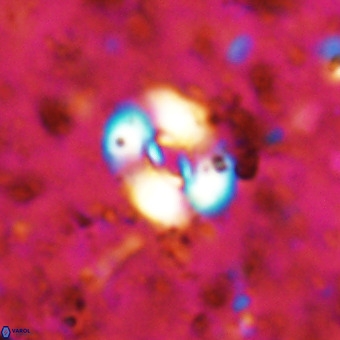 Watznaueria fossacincta VR 20827