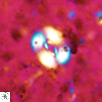 Watznaueria fossacincta VR 20827