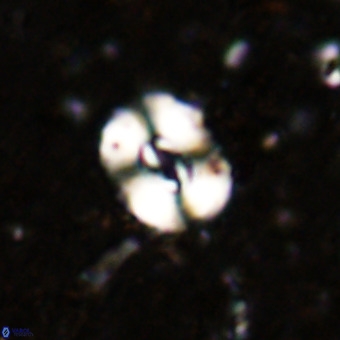 Watznaueria fossacincta VR 20829