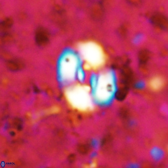 Watznaueria fossacincta VR 20831