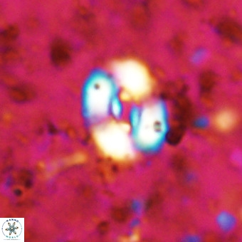 Watznaueria fossacincta VR 20831