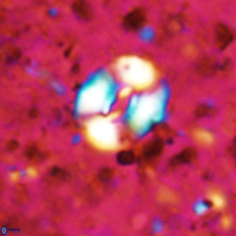 Watznaueria fossacincta VR 20837