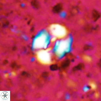 Watznaueria fossacincta VR 20837