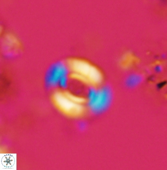 Watznaueria gresslyi 1424