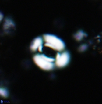 Watznaueria gresslyi 1425