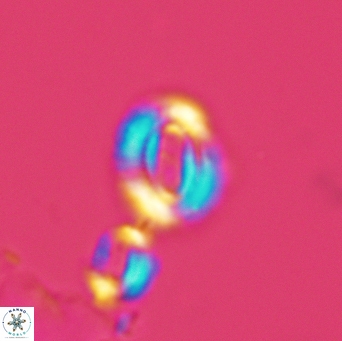 Watznaueria gresslyi 3524