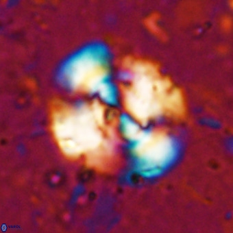 Watznaueria leesiae VR 21474