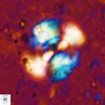 Watznaueria leesiae VR 21477