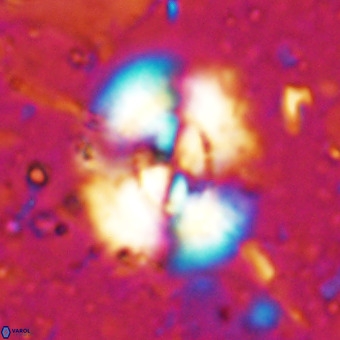 Watznaueria leesiae VR 21470