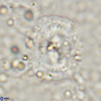 Watznaueria leesiae VR 21484