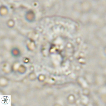 Watznaueria leesiae VR 21484
