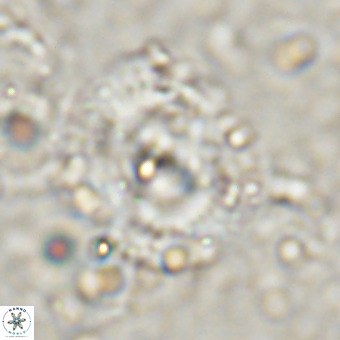 Watznaueria leesiae VR 21486