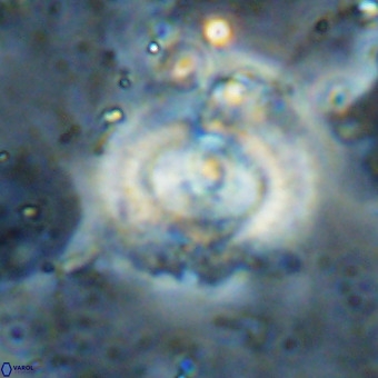 Watznaueria leesiae VR 21487