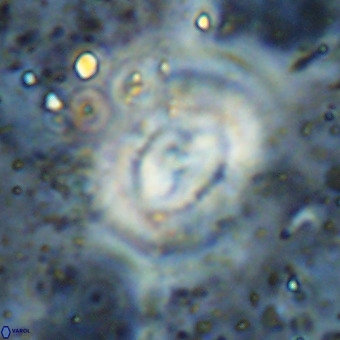 Watznaueria leesiae VR 21489