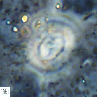 Watznaueria leesiae VR 21489