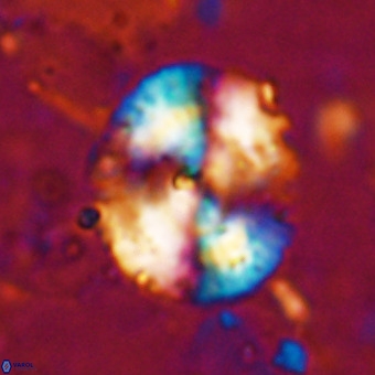 Watznaueria leesiae VR 21481