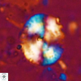 Watznaueria leesiae VR 21481
