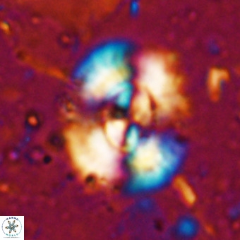 Watznaueria leesiae VR 21482