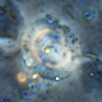 Watznaueria leesiae VR 21494