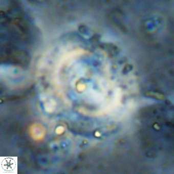 Watznaueria leesiae VR 21494