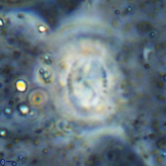 Watznaueria leesiae VR 21491
